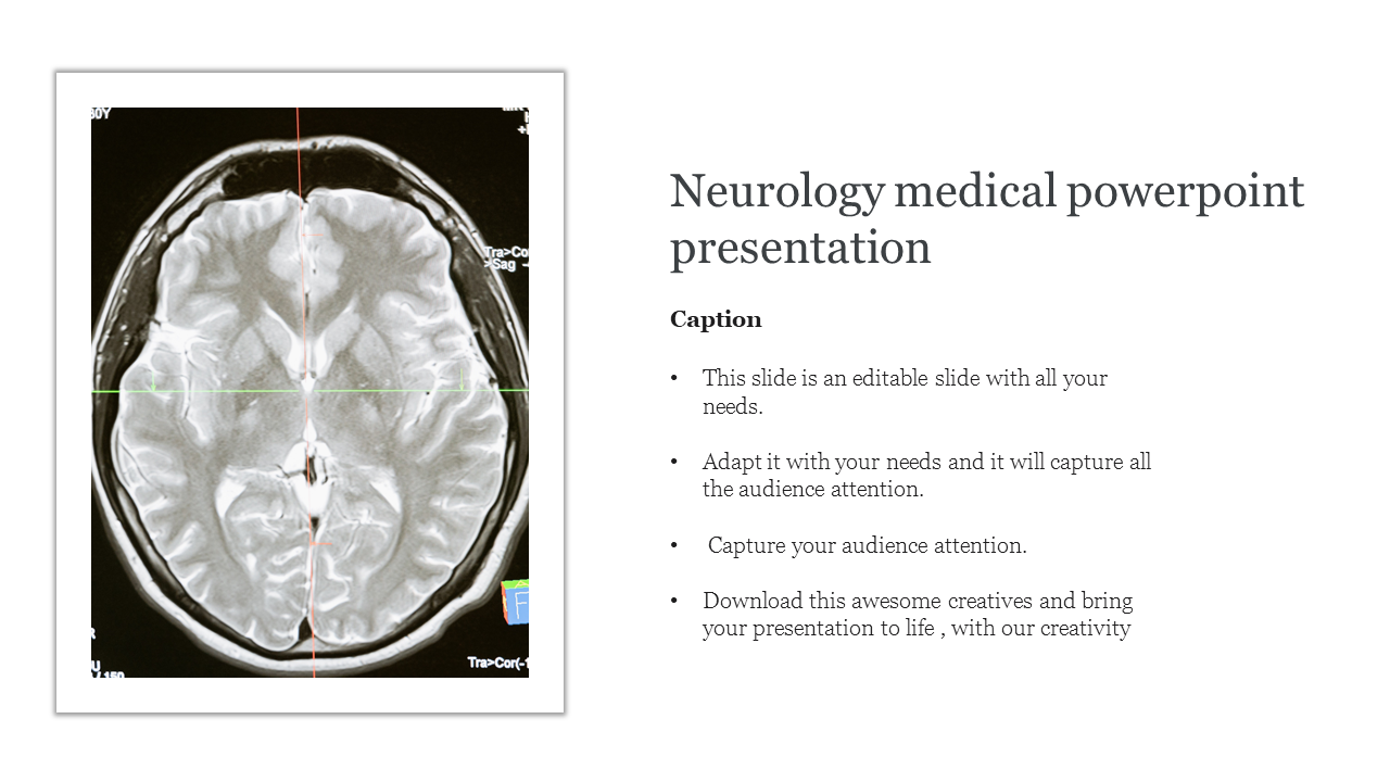 Use Amazing Neurology Medical PowerPoint Presentation